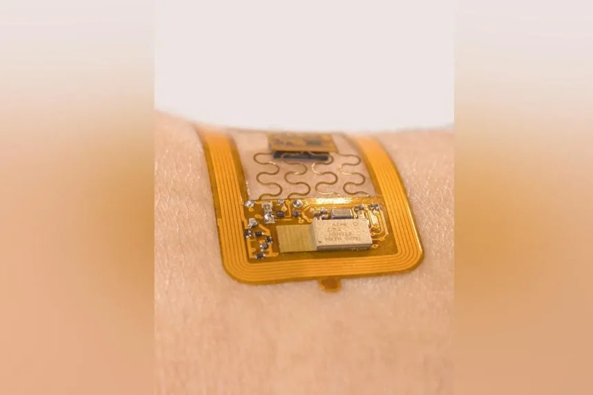 Skin patch