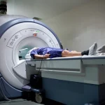 Prostate